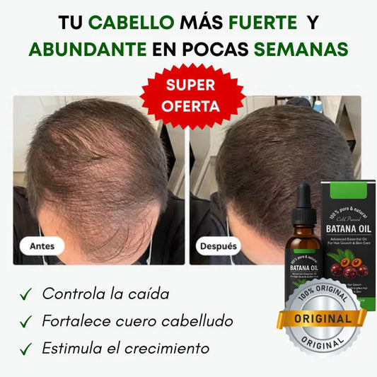 Aceite de Batana: Promo 2x1